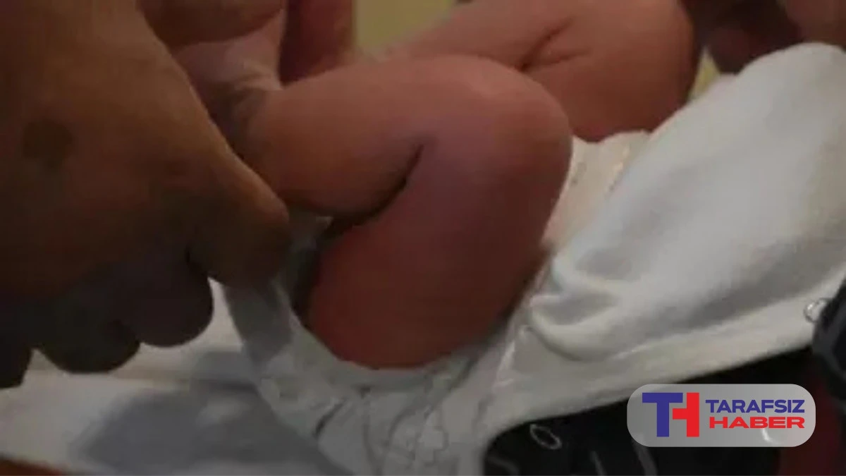 S&uuml;nnet edilen 27 g&uuml;nl&uuml;k bebek &ouml;ld&uuml;